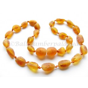 baltic amber teething necklace